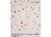TableTop compact laminate rond 80cm pebbles